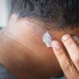 Mann cremt seine Dermatitis am Hinterkopf ein.